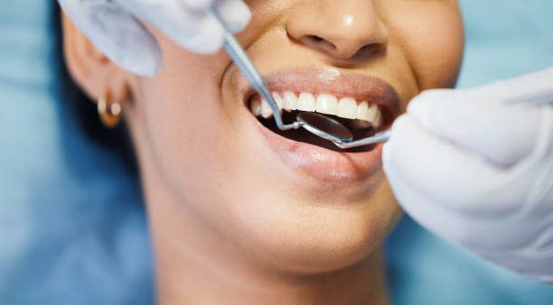 Best Emergency Dental Care for Broken or Chipped Teeth in Palm Shores, FL